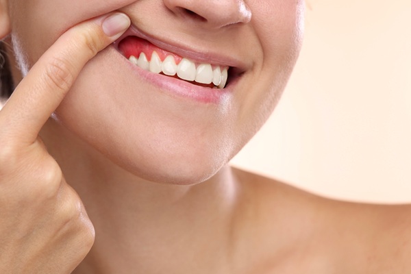 Gum Disease Treatment Options: From Deep Cleanings To Ongoing Maintenance