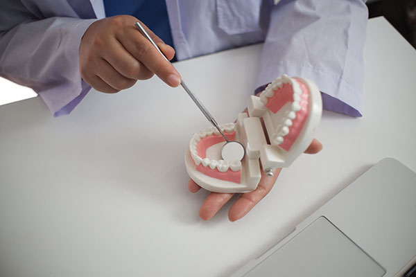What Is An Oral Cancer Screening From A General Dentist